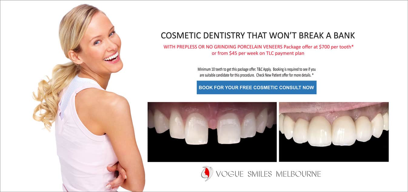 Composite Veneers versus Porcelain Veneers Melbourne CBD- best Cosmetic dentist in Melbourne CBD Victoria Australia