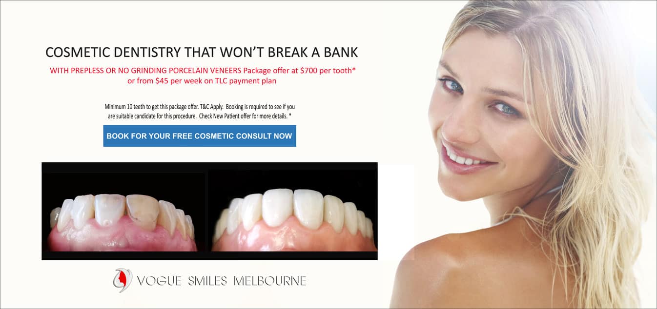 Porcelain Veneer Specials and Packages in Melbourne WITH PREPLESS / NO-PREP OR NO GRINDING -BEST DENTIST IN MELBOURNE - BEST COSMETIC DENTIST IN MELBOURNE CBD