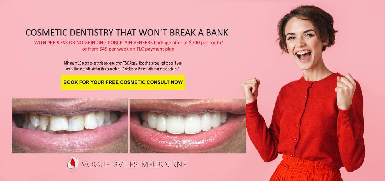 Affordable Dentist In Melbourne CBD - Dentist special offer Melbourne CBD City Victoria, Australia, Dental Deals and discount Melbourne CBD, cheap dental clinic near me, Melbourne Dentist Special Offers, Affordable Dental Care