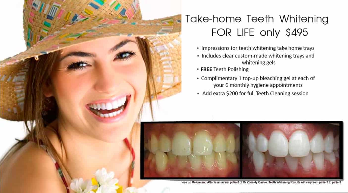 TEETH WHITENING SPECIALS ANC PACKAGES MELBOURNE CBD