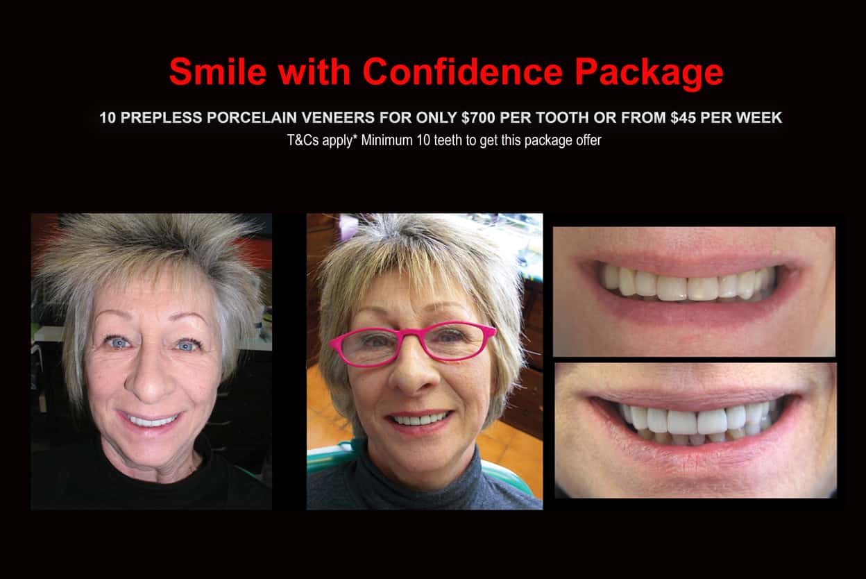 How to Look Younger with Smile Rejuvenation and Smile Makeovers treatment in Melbourne. Look and feel younger without surgical procedures with Cosmetic Dentistry in Melbourne CBD