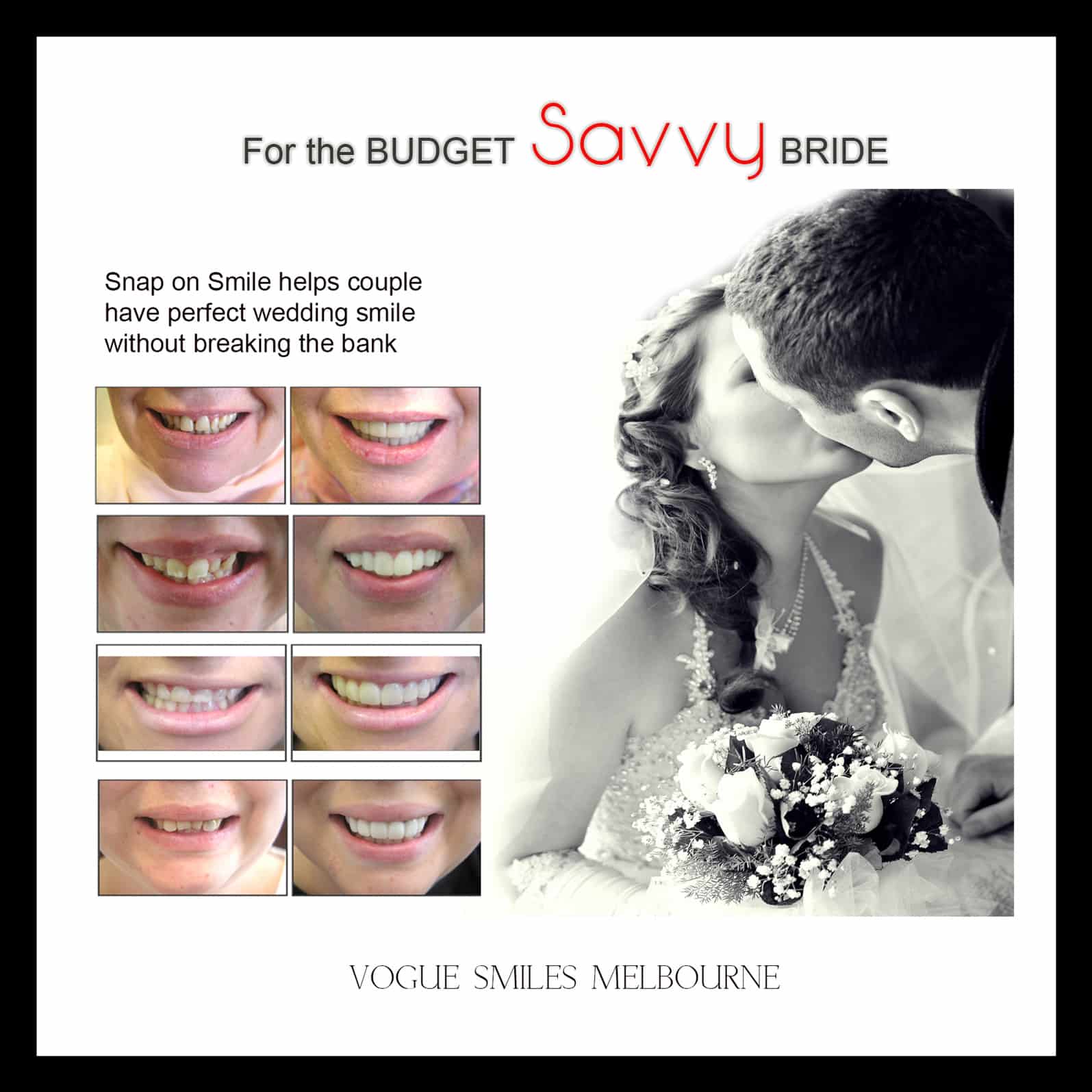 Wedding Smile Makeover Specials and Packages in Melbourne | Cosmetic Dentistry Bride and Groom BRIDAL wedding package deals | cheap wedding packages Melbourne