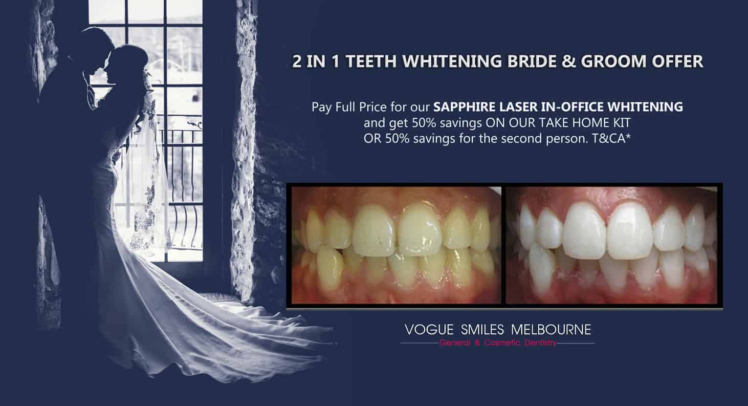 Wedding Smile Makeover Specials and Packages in Melbourne | Cosmetic Dentistry Bride and Groom BRIDAL wedding package deals | cheap wedding packages Melbourne