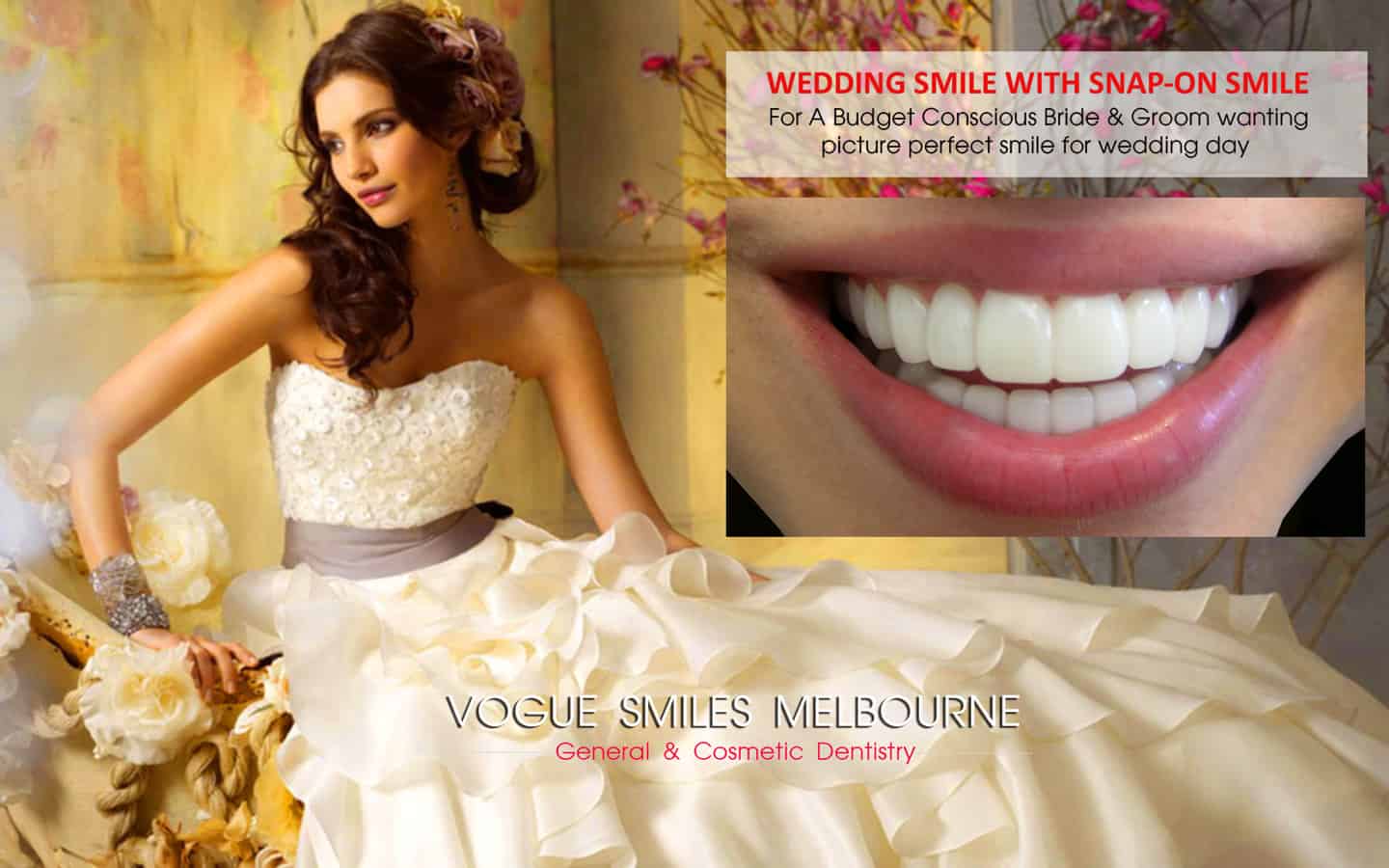 Wedding Smile Makeover Specials and Packages in Melbourne | Cosmetic Dentistry Bride and Groom BRIDAL wedding package deals | cheap wedding packages Melbourne