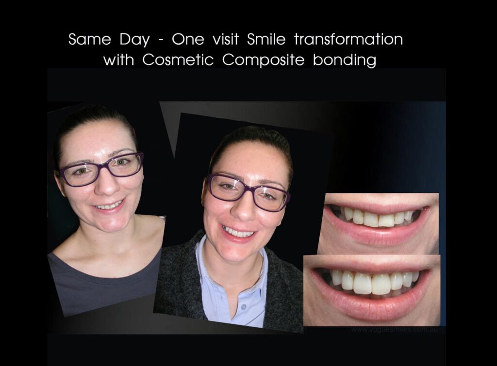 Vogue Smiles Melbourne - Vogue Dentist - Vogue Dental Melbourne -Best Cosmetic dentist in Melbourne CBD