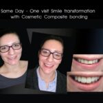 Vogue Smiles Melbourne - Vogue Dentist - Vogue Dental Melbourne -Best Cosmetic dentist in Melbourne CBD