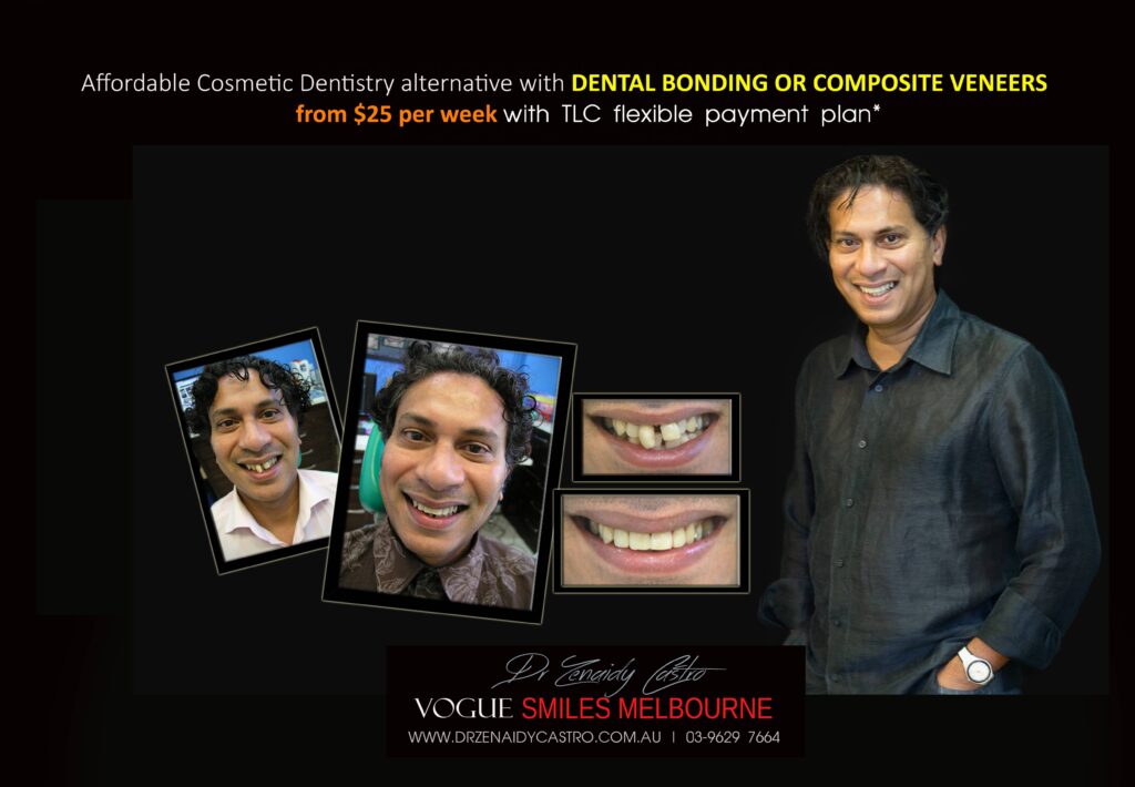 AFFORDABLE-COSMETIC-DENTISTRY-MAKEOVER-WITH-DENTAL-BONDING-MELBOURNE-28-scaled.jpg