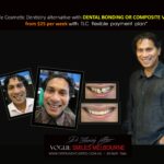 AFFORDABLE-COSMETIC-DENTISTRY-MAKEOVER-WITH-DENTAL-BONDING-MELBOURNE-28-scaled.jpg