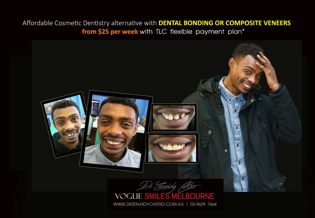 AFFORDABLE-COSMETIC-DENTISTRY-MAKEOVER-WITH-DENTAL-BONDING-MELBOURNE-29-scaled.jpg