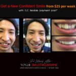 Vogue Smiles Melbourne - Vogue Dentist - Vogue Dental Melbourne -Best Cosmetic dentist in Melbourne CBD