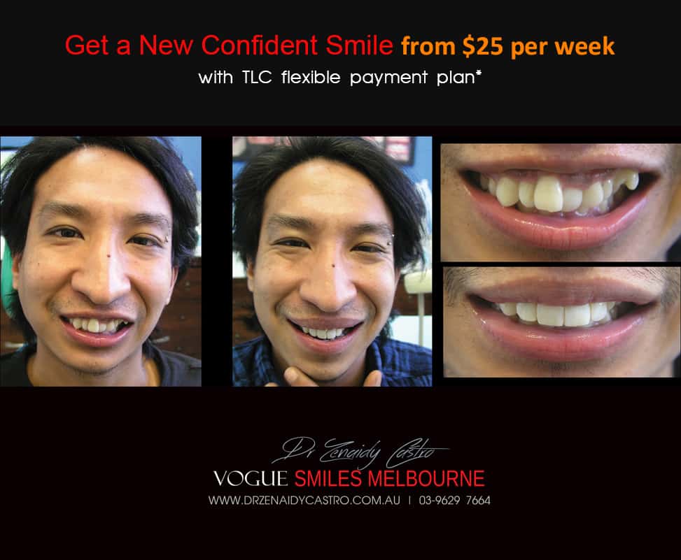Vogue Smiles Melbourne - Vogue Dentist - Vogue Dental Melbourne -Best Cosmetic dentist in Melbourne CBD