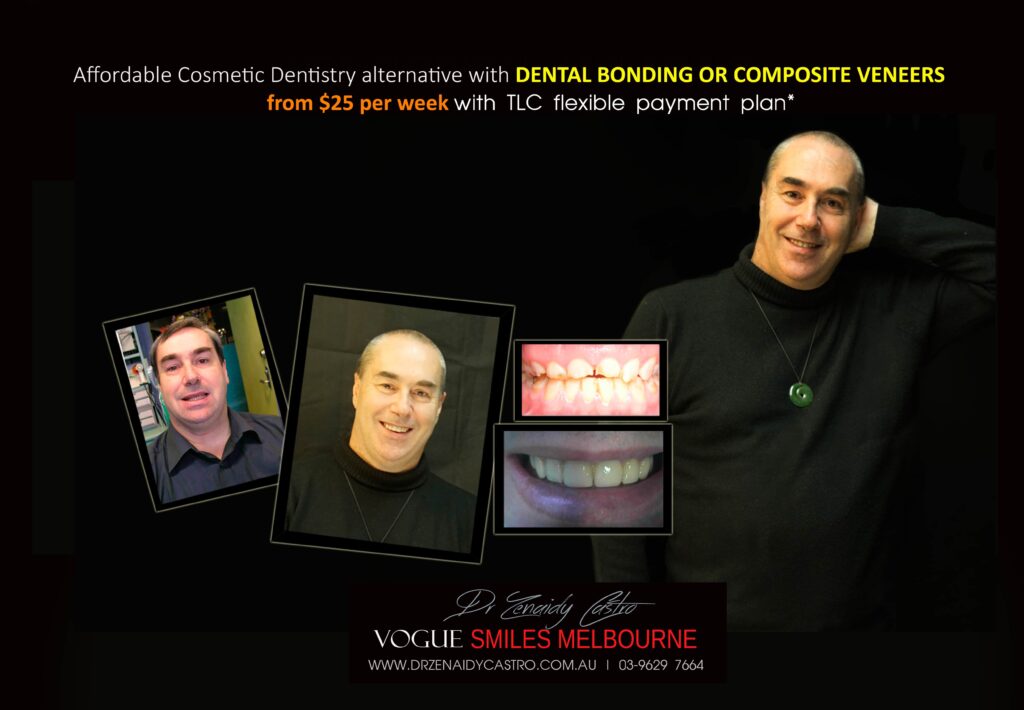 AFFORDABLE-COSMETIC-DENTISTRY-MAKEOVER-WITH-DENTAL-BONDING-MELBOURNE-30-scaled.jpg