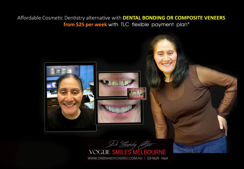 AFFORDABLE-COSMETIC-DENTISTRY-MAKEOVER-WITH-DENTAL-BONDING-MELBOURNE-31-scaled.jpg