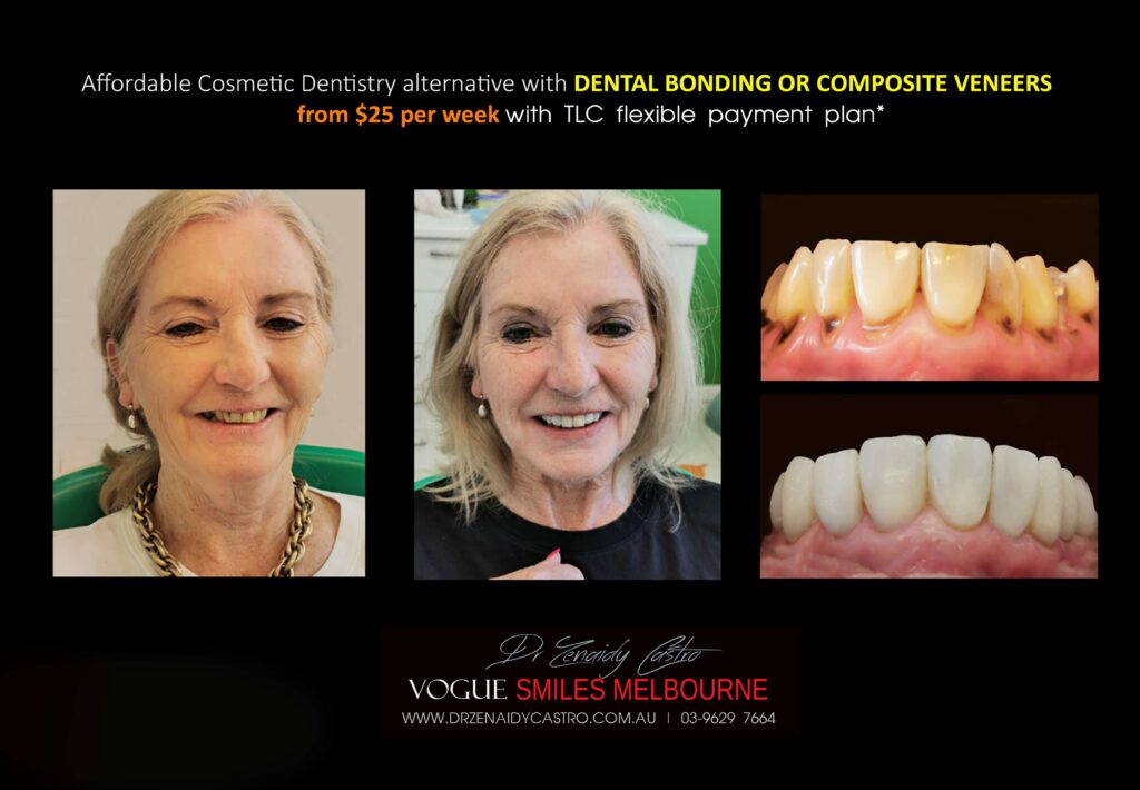 AFFORDABLE-COSMETIC-DENTISTRY-MAKEOVER-WITH-DENTAL-BONDING-MELBOURNE-33-scaled.jpg