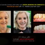 AFFORDABLE-COSMETIC-DENTISTRY-MAKEOVER-WITH-DENTAL-BONDING-MELBOURNE-33-scaled.jpg