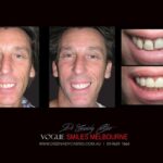 Vogue Smiles Melbourne - Vogue Dentist - Vogue Dental Melbourne -Best Cosmetic dentist in Melbourne CBD
