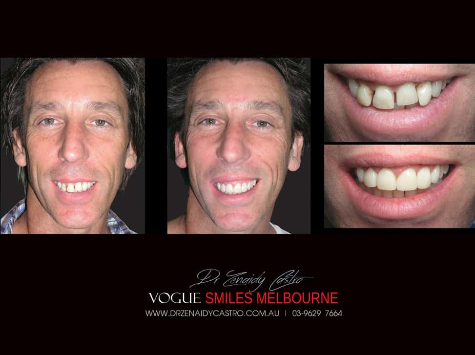 Vogue Smiles Melbourne - Vogue Dentist - Vogue Dental Melbourne -Best Cosmetic dentist in Melbourne CBD