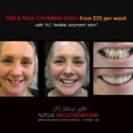 Vogue Smiles Melbourne - Vogue Dentist - Vogue Dental Melbourne -Best Cosmetic dentist in Melbourne CBD