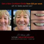 AFFORDABLE-COSMETIC-DENTISTRY-MAKEOVER-WITH-DENTAL-BONDING-MELBOURNE-9.jpg