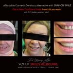 AFFORDABLE-COSMETIC-DENTISTRY-MAKEOVER-WITH-SNAP-ON-SMILE-MELBOURNE-1-scaled.jpg