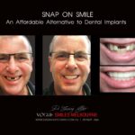 AFFORDABLE-COSMETIC-DENTISTRY-MAKEOVER-WITH-SNAP-ON-SMILE-MELBOURNE-10-scaled.jpg