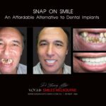 SNAP ON SMILE