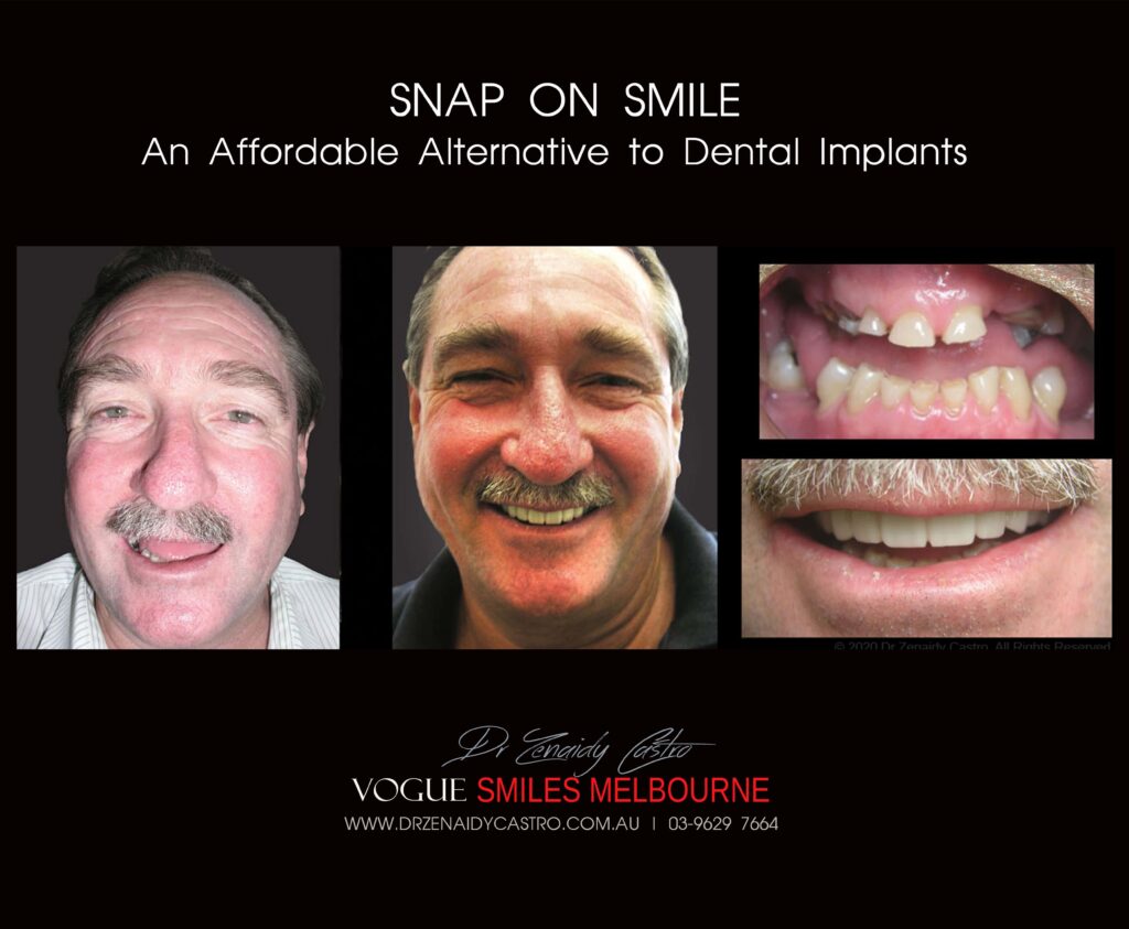 Vogue Smiles Melbourne - Vogue Dentist - Vogue Dental Melbourne -Best Cosmetic dentist in Melbourne CBD