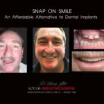 Vogue Smiles Melbourne - Vogue Dentist - Vogue Dental Melbourne -Best Cosmetic dentist in Melbourne CBD