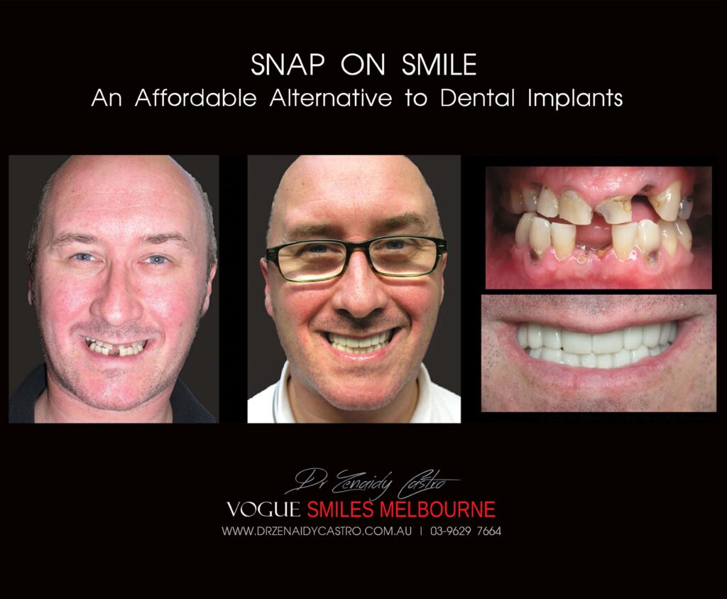 Vogue Smiles Melbourne - Vogue Dentist - Vogue Dental Melbourne -Best Cosmetic dentist in Melbourne CBD