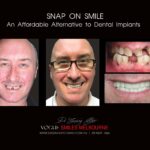 Vogue Smiles Melbourne - Vogue Dentist - Vogue Dental Melbourne -Best Cosmetic dentist in Melbourne CBD