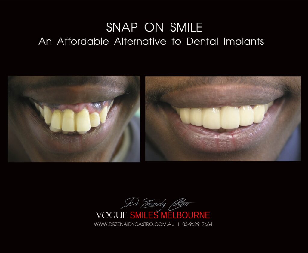 Vogue Smiles Melbourne - Vogue Dentist - Vogue Dental Melbourne -Best Cosmetic dentist in Melbourne CBD