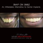 Vogue Smiles Melbourne - Vogue Dentist - Vogue Dental Melbourne -Best Cosmetic dentist in Melbourne CBD