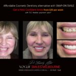 AFFORDABLE-COSMETIC-DENTISTRY-MAKEOVER-WITH-SNAP-ON-SMILE-MELBOURNE-3-scaled.jpg