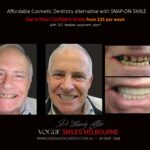 AFFORDABLE-COSMETIC-DENTISTRY-MAKEOVER-WITH-SNAP-ON-SMILE-MELBOURNE-4-scaled.jpg