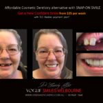 AFFORDABLE-COSMETIC-DENTISTRY-MAKEOVER-WITH-SNAP-ON-SMILE-MELBOURNE-5-scaled.jpg