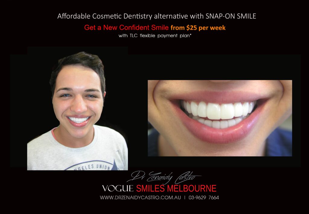 AFFORDABLE-COSMETIC-DENTISTRY-MAKEOVER-WITH-SNAP-ON-SMILE-MELBOURNE-6-scaled.jpg