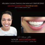 AFFORDABLE-COSMETIC-DENTISTRY-MAKEOVER-WITH-SNAP-ON-SMILE-MELBOURNE-6-scaled.jpg