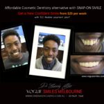 AFFORDABLE-COSMETIC-DENTISTRY-MAKEOVER-WITH-SNAP-ON-SMILE-MELBOURNE-7-scaled.jpg