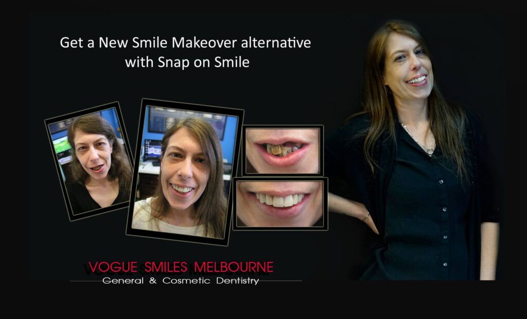 AFFORDABLE-COSMETIC-DENTISTRY-MAKEOVER-WITH-SNAP-ON-SMILE-MELBOURNE-9.jpg