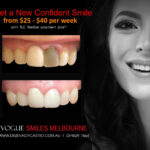 BLACK-TOOTH-DEAD-FRONT-TOOTH-MAKEOVERS-MELBOURNE-1.jpg