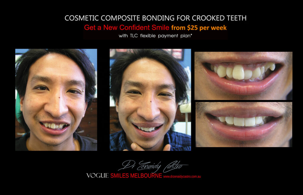 Vogue Smiles Melbourne - Vogue Dentist - Vogue Dental Melbourne -Best Cosmetic dentist in Melbourne CBD