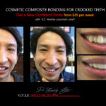 Vogue Smiles Melbourne - Vogue Dentist - Vogue Dental Melbourne -Best Cosmetic dentist in Melbourne CBD