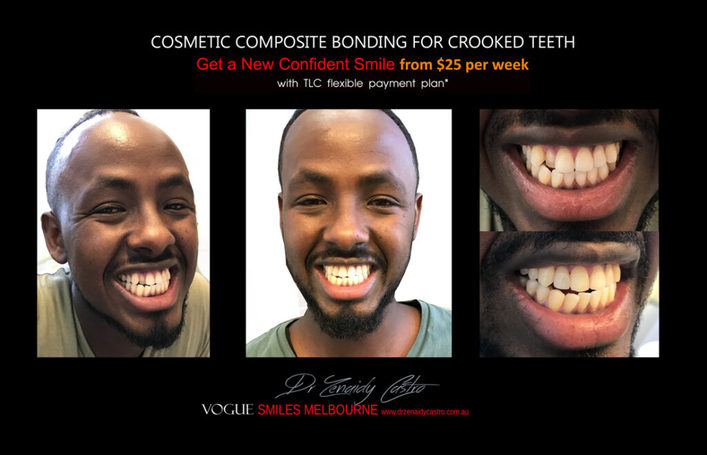 Vogue Smiles Melbourne - Vogue Dentist - Vogue Dental Melbourne -Best Cosmetic dentist in Melbourne CBD
