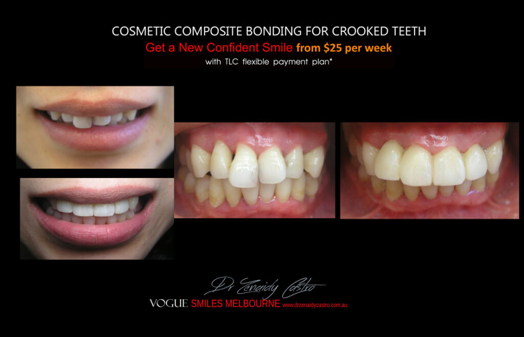 Vogue Smiles Melbourne - Vogue Dentist - Vogue Dental Melbourne -Best Cosmetic dentist in Melbourne CBD