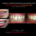 Vogue Smiles Melbourne - Vogue Dentist - Vogue Dental Melbourne -Best Cosmetic dentist in Melbourne CBD