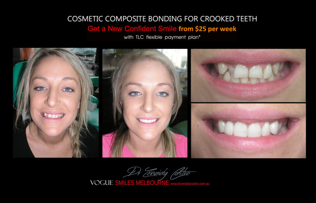 Vogue Smiles Melbourne - Vogue Dentist - Vogue Dental Melbourne -Best Cosmetic dentist in Melbourne CBD