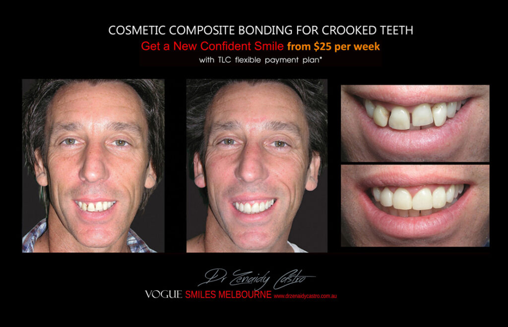 Vogue Smiles Melbourne - Vogue Dentist - Vogue Dental Melbourne -Best Cosmetic dentist in Melbourne CBD