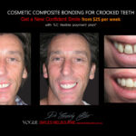 Vogue Smiles Melbourne - Vogue Dentist - Vogue Dental Melbourne -Best Cosmetic dentist in Melbourne CBD