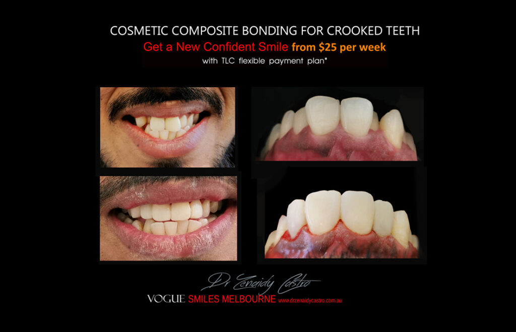 Vogue Smiles Melbourne - Vogue Dentist - Vogue Dental Melbourne -Best Cosmetic dentist in Melbourne CBD