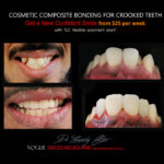 Vogue Smiles Melbourne - Vogue Dentist - Vogue Dental Melbourne -Best Cosmetic dentist in Melbourne CBD